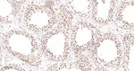 USP28 Antibody in Immunohistochemistry (Paraffin) (IHC (P))