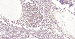 USP28 Antibody in Immunohistochemistry (Paraffin) (IHC (P))