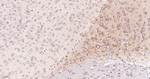GARS Recombinant Rabbit Monoclonal Antibody (5E6)