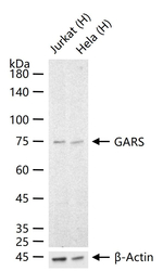 GARS Antibody in Western Blot (WB)