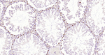 SOX9 Antibody in Immunohistochemistry (Paraffin) (IHC (P))