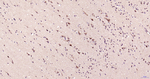 MEK2 Antibody in Immunohistochemistry (Paraffin) (IHC (P))