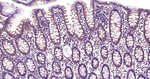 MEK2 Antibody in Immunohistochemistry (Paraffin) (IHC (P))