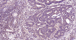 MEK2 Antibody in Immunohistochemistry (Paraffin) (IHC (P))
