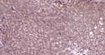 MEK2 Antibody in Immunohistochemistry (Paraffin) (IHC (P))