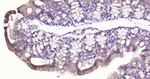 E-cadherin Antibody in Immunohistochemistry (Paraffin) (IHC (P))