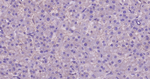 E-cadherin Antibody in Immunohistochemistry (Paraffin) (IHC (P))