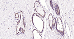 E-cadherin Antibody in Immunohistochemistry (Paraffin) (IHC (P))