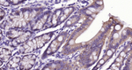 E-cadherin Antibody in Immunohistochemistry (Paraffin) (IHC (P))