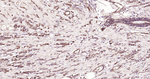 E-cadherin Antibody in Immunohistochemistry (Paraffin) (IHC (P))