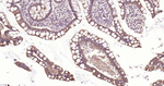 E-cadherin Antibody in Immunohistochemistry (Paraffin) (IHC (P))