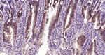 E-cadherin Antibody in Immunohistochemistry (Paraffin) (IHC (P))
