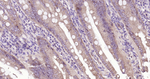 E-cadherin Antibody in Immunohistochemistry (Paraffin) (IHC (P))