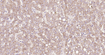 E-cadherin Antibody in Immunohistochemistry (Paraffin) (IHC (P))
