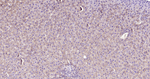 E-cadherin Antibody in Immunohistochemistry (Paraffin) (IHC (P))