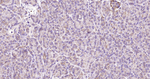E-cadherin Antibody in Immunohistochemistry (Paraffin) (IHC (P))