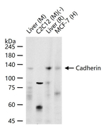 E-cadherin Antibody in Western Blot (WB)