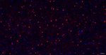 S100A1 Antibody in Immunohistochemistry (Paraffin) (IHC (P))