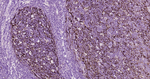 S100A1 Antibody in Immunohistochemistry (Paraffin) (IHC (P))