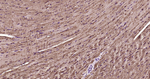 S100A1 Antibody in Immunohistochemistry (Paraffin) (IHC (P))