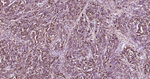 S100A1 Antibody in Immunohistochemistry (Paraffin) (IHC (P))