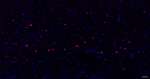 S100A1 Antibody in Immunohistochemistry (Paraffin) (IHC (P))