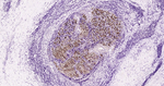 S100A1 Antibody in Immunohistochemistry (Paraffin) (IHC (P))