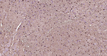 S100A1 Antibody in Immunohistochemistry (Paraffin) (IHC (P))