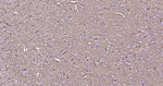 S100A1 Antibody in Immunohistochemistry (Paraffin) (IHC (P))