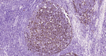 S100A1 Antibody in Immunohistochemistry (Paraffin) (IHC (P))
