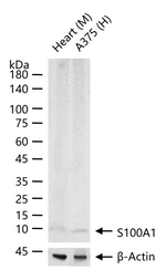 S100A1 Antibody in Western Blot (WB)
