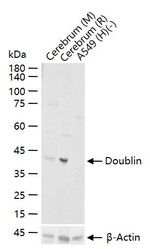 Doublecortin Recombinant Rabbit Monoclonal Antibody (5H2)