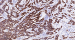 p16INK4a Antibody in Immunohistochemistry (Paraffin) (IHC (P))