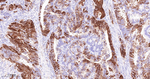 p16INK4a Antibody in Immunohistochemistry (Paraffin) (IHC (P))