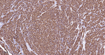 p16INK4a Antibody in Immunohistochemistry (Paraffin) (IHC (P))