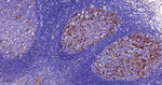 p16INK4a Antibody in Immunohistochemistry (Paraffin) (IHC (P))