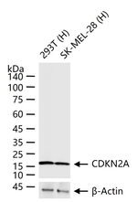 p16INK4a Antibody in Western Blot (WB)