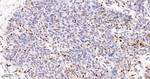 ATM Antibody in Immunohistochemistry (Paraffin) (IHC (P))