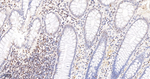 ATM Recombinant Rabbit Monoclonal Antibody (3H2)