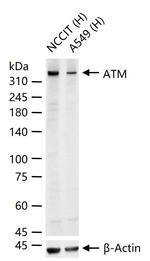 ATM Antibody in Western Blot (WB)