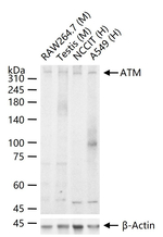ATM Recombinant Rabbit Monoclonal Antibody (9H6)