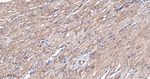 BAD Antibody in Immunohistochemistry (Paraffin) (IHC (P))