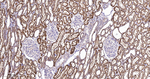 BAD Antibody in Immunohistochemistry (Paraffin) (IHC (P))