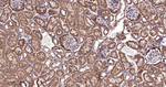 BAD Antibody in Immunohistochemistry (Paraffin) (IHC (P))