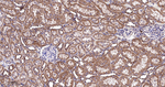 BAD Antibody in Immunohistochemistry (Paraffin) (IHC (P))