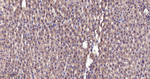 BAD Antibody in Immunohistochemistry (Paraffin) (IHC (P))