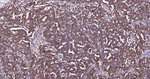 BAD Antibody in Immunohistochemistry (Paraffin) (IHC (P))