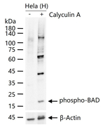 Phospho-BAD (Ser75) Recombinant Rabbit Monoclonal Antibody (10H11)