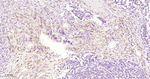 FAP Antibody in Immunohistochemistry (Paraffin) (IHC (P))