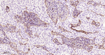 FAP Recombinant Rabbit Monoclonal Antibody (4C4)